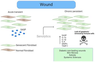 Aging, senescence, and cutaneous wound healing—a complex relationship